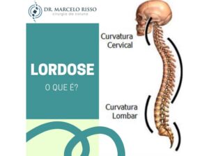 dr marcelo lordose
