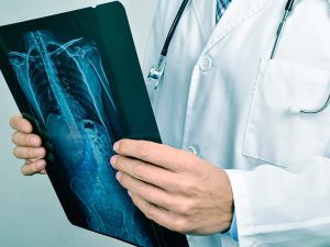 doctor observing a skeleton radiograph