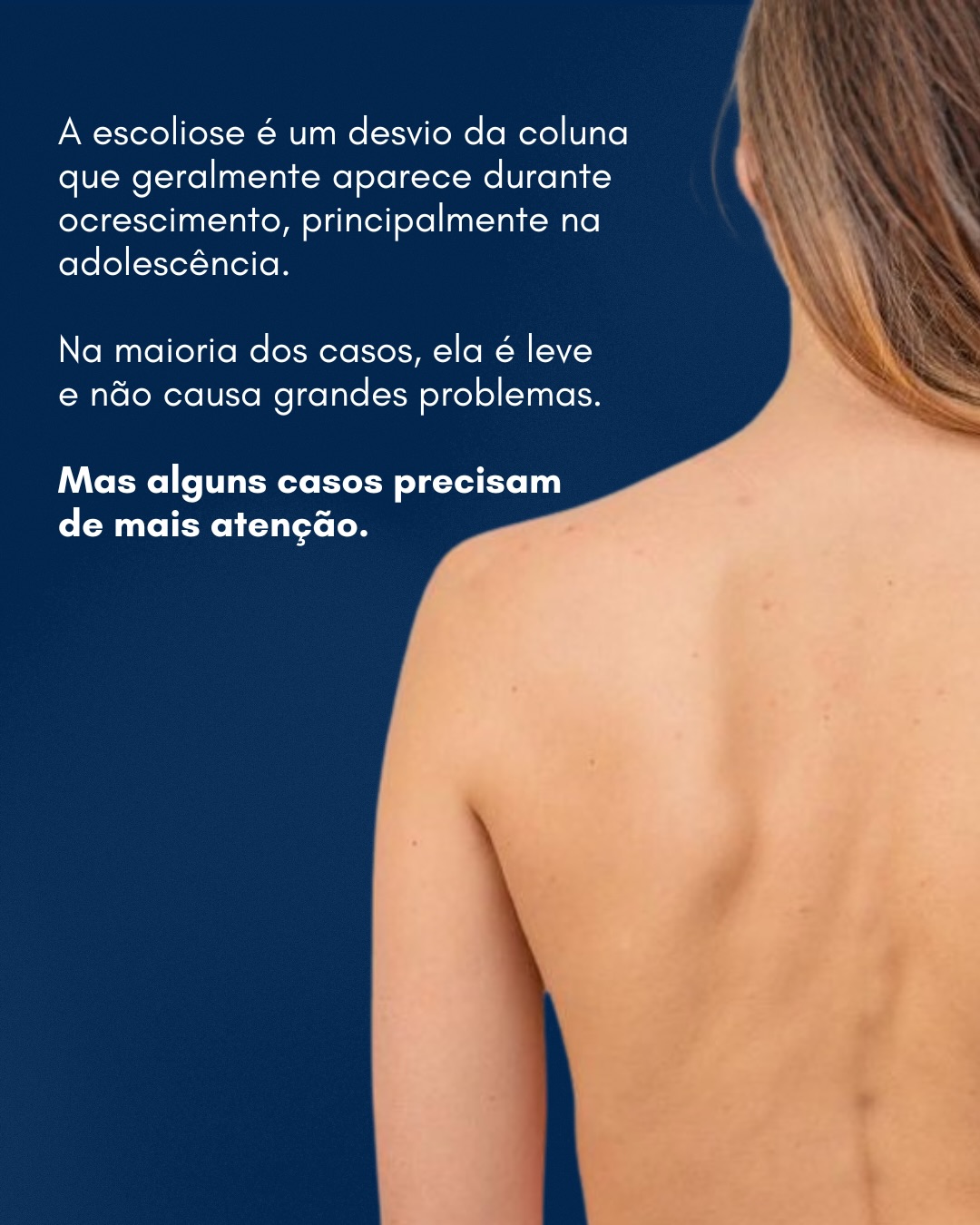 dr marcelo slide escoliose 02